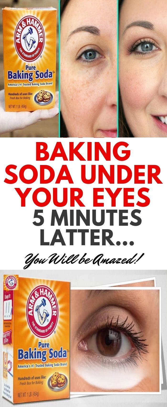 Apply Baking Soda Under Your Eyes…5 Minutes Latter…You Will be Amazed!