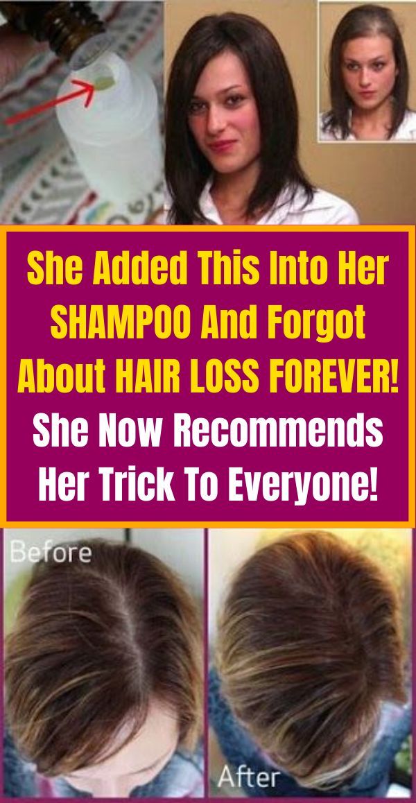She Added This into Her SHAMPOO and About Hair Loss FOREVER! She Now Her Trick