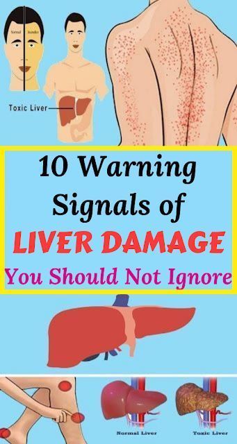 10 Warning Signals of Liver Damage You Should Not Ignore