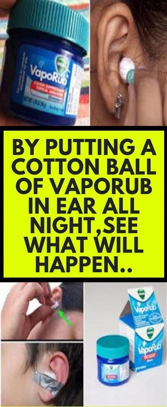 By Putting A Cotton Ball Of VapoRub In Ear All Night See What Will Happen..